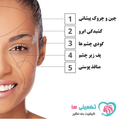 میکرو کرم اینستنتلی ایجلس Instantly Ageless