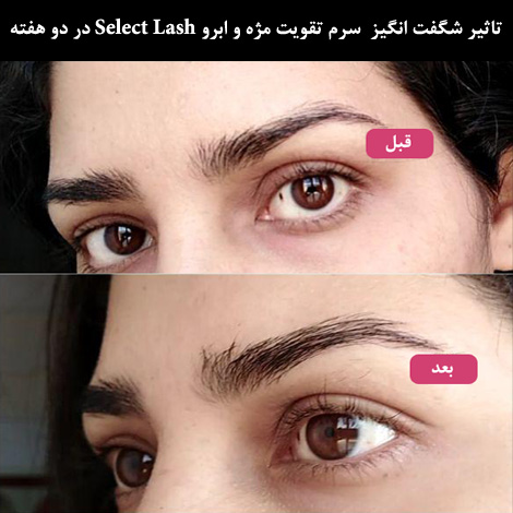 تاثیر سرم تقویت رشد مژه Select Lash