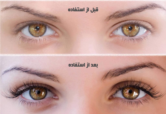 تاثیر سرم تقویت رشد مژه سینوز