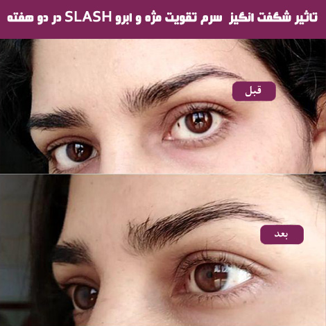 تاثیر سرم تقویت رشد مژه SLASH