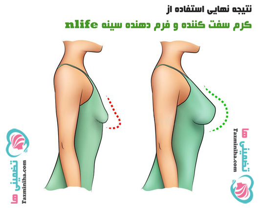 بزرگ کردن سینه بوسیله nlife بزرگ کردن سینه