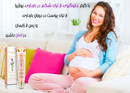 ترک نخوردن شکم در بارداری , خرید کرم جلوگیری از ترک شکم , کرم ترک شکم بعد از زایمان , قیمت کرم ترک شکم در بارداری , چکار کنیم در بارداری شکم ترک نخورد , ترک بارداری از کی شروع میشه