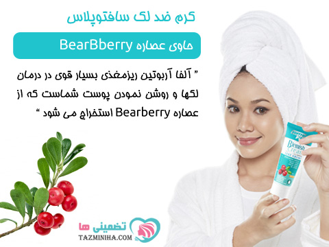 ترکیبات گیاهی کرم ضد لک قوی صورت سافتوپلاس ترکیبات گیاهی کرم ضد لک قوی صورت سافتوپلاس